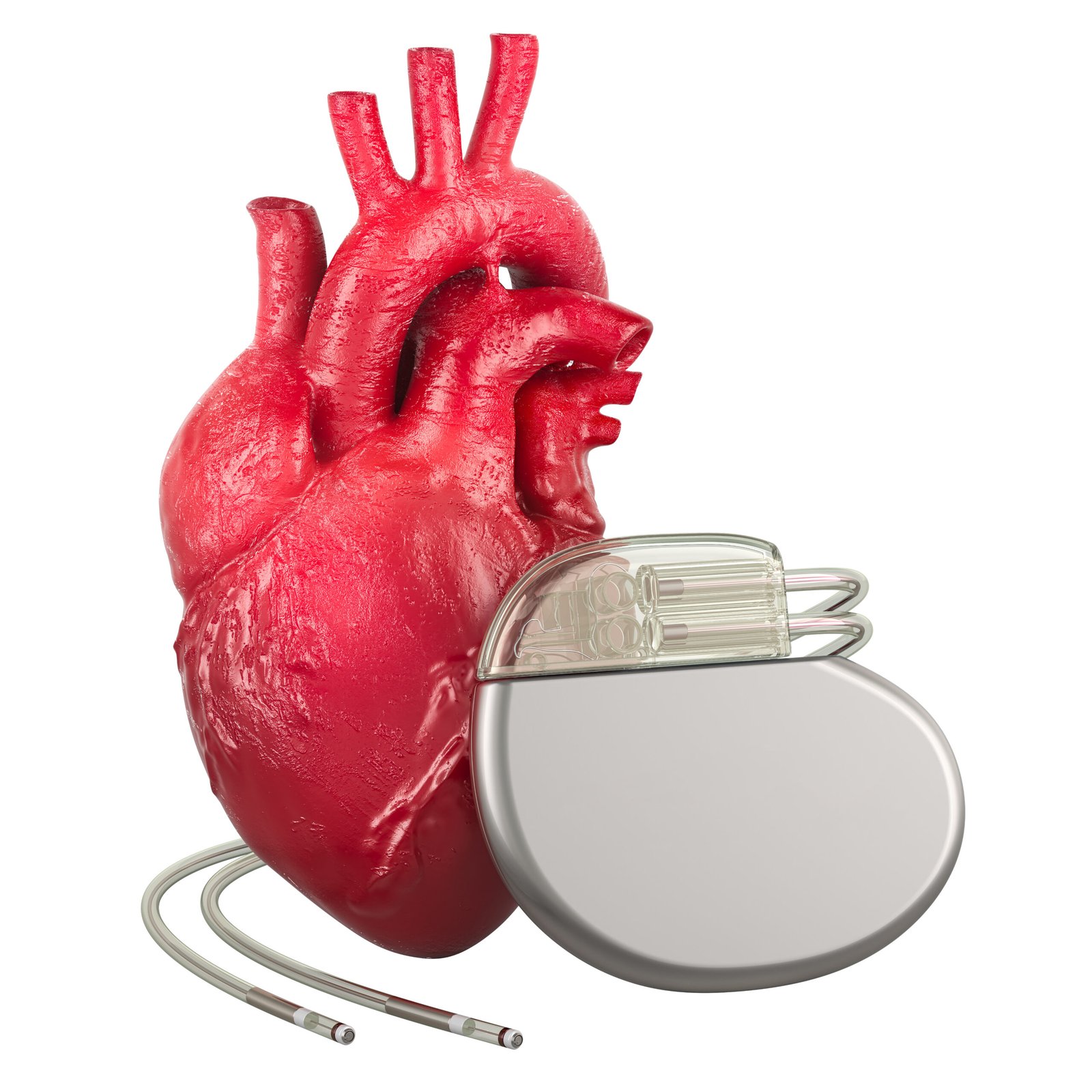 Human heart with Implantable Cardiac Device, 3D rendering isolated on transparent background